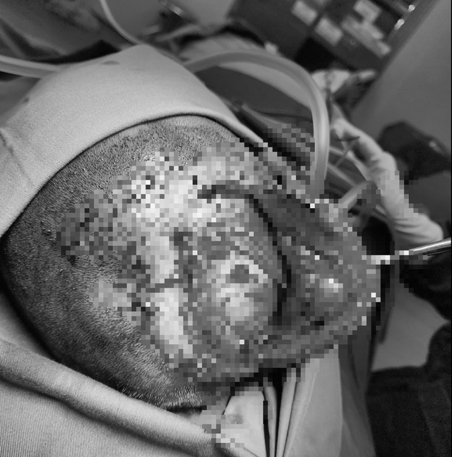 Vụ nhiều người thương vong sau tai nạn trên cao tốc: Tình trạng sức khỏe các nạn nhân hiện ra sao?